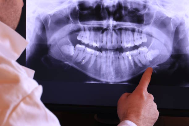 Best Weekend Emergency Dental Services in Wye, MT